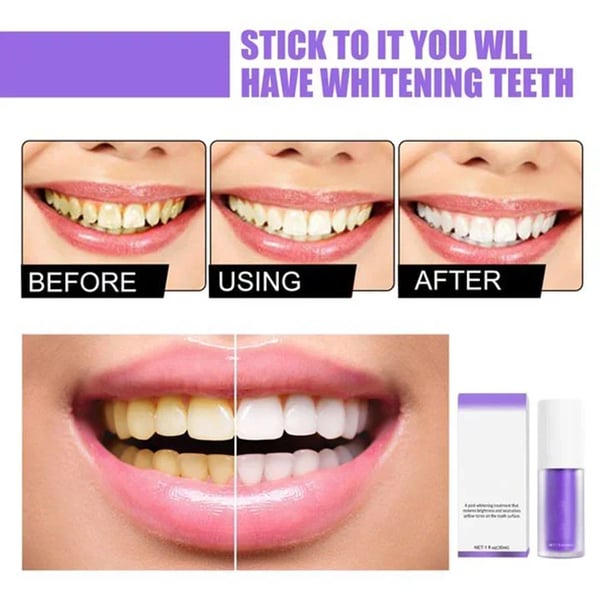 HORUSLY Teeth Colour Corrector Serum