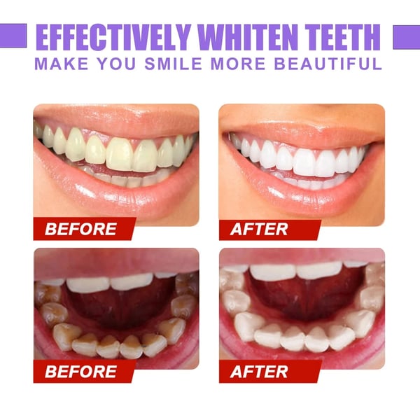 HORUSLY Teeth Colour Corrector Serum